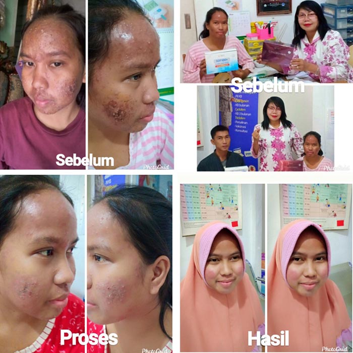 Testimoni-Utsukushhii-Jasa-Landingpage-5.jpg