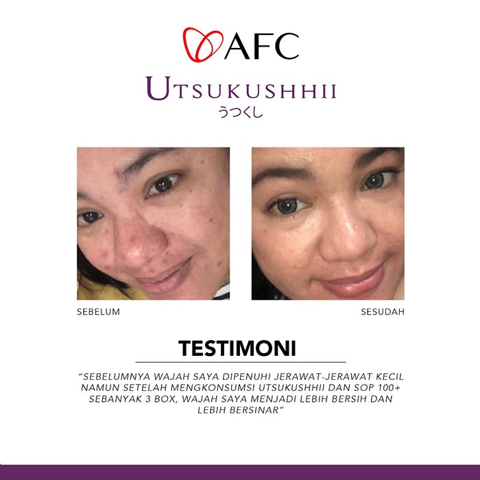 Testimoni-Utsukushhii-Jasa-Landingpage-6.jpg
