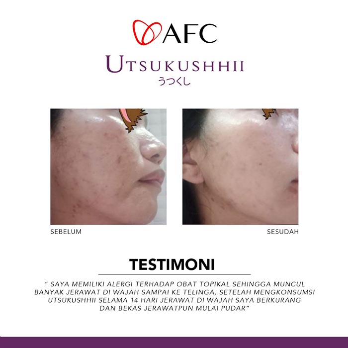 Testimoni-Utsukushhii-Jasa-Landingpage-7.jpg